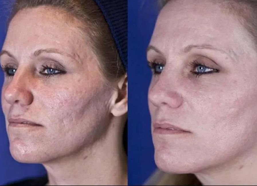 Пример работы