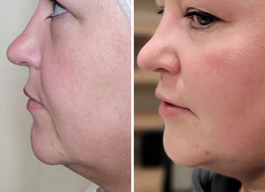 Пример работы