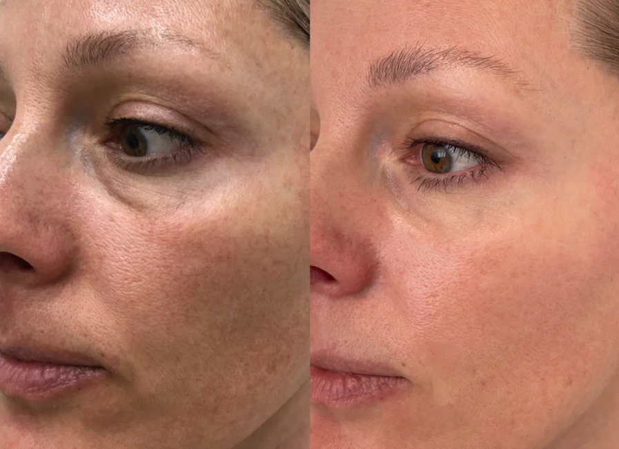 Пример работы