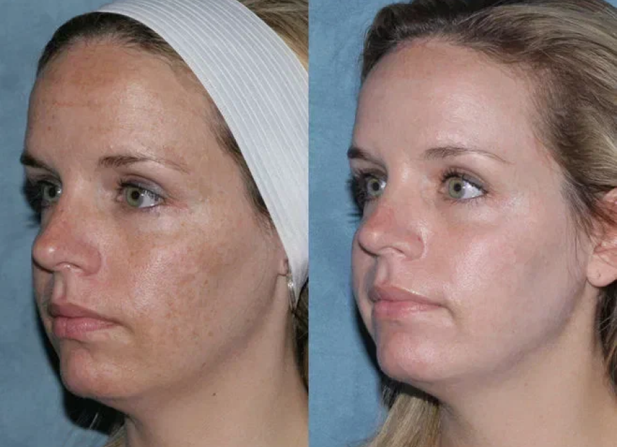 Пример работы