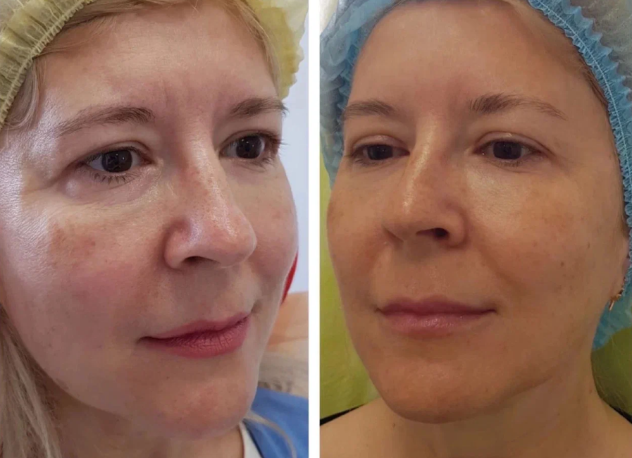 Пример работы