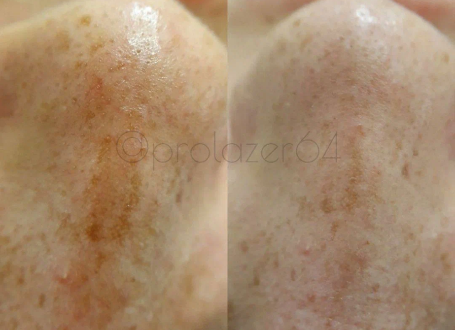 Пример работы