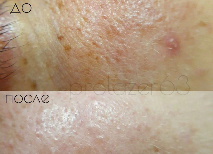 Пример работы