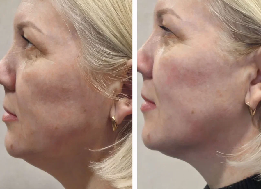 Пример работы