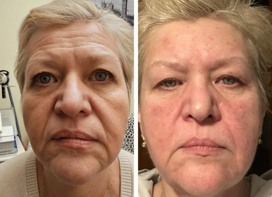 Пример работы