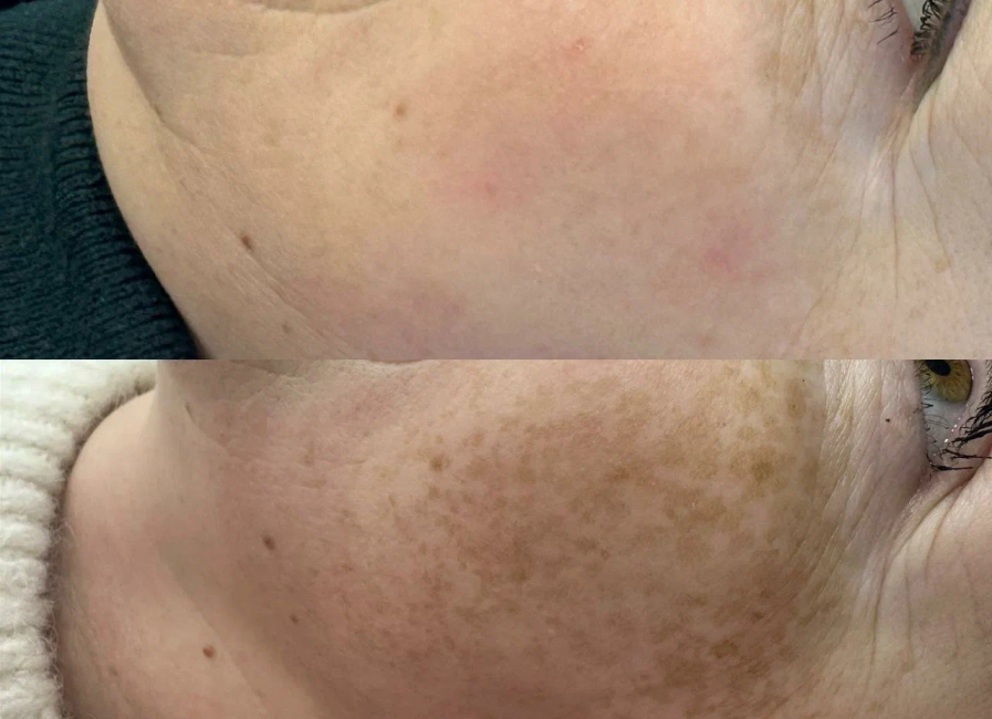 Пример работы