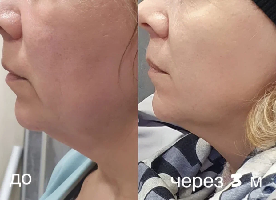 Пример работы