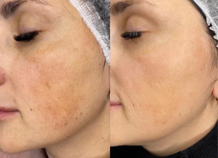 Пример работы