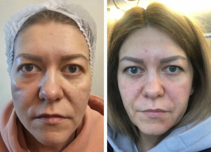 Пример работы