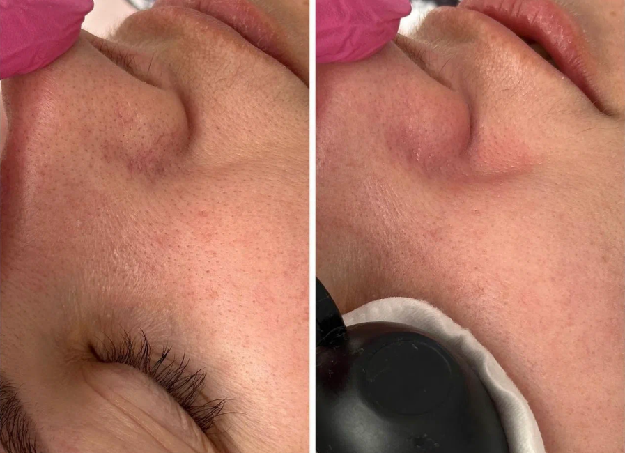 Пример работы