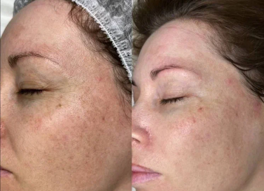 Пример работы