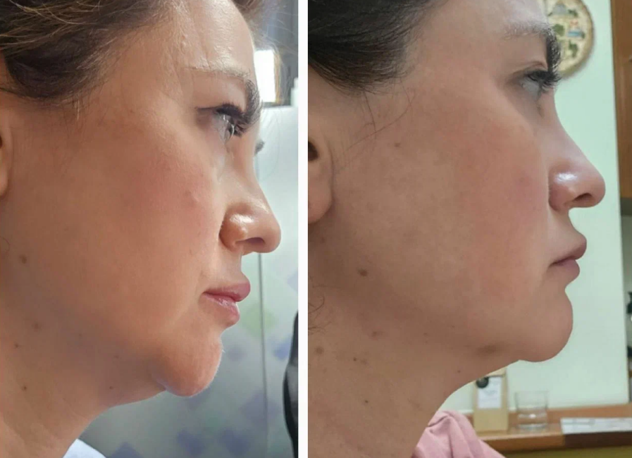 Пример работы