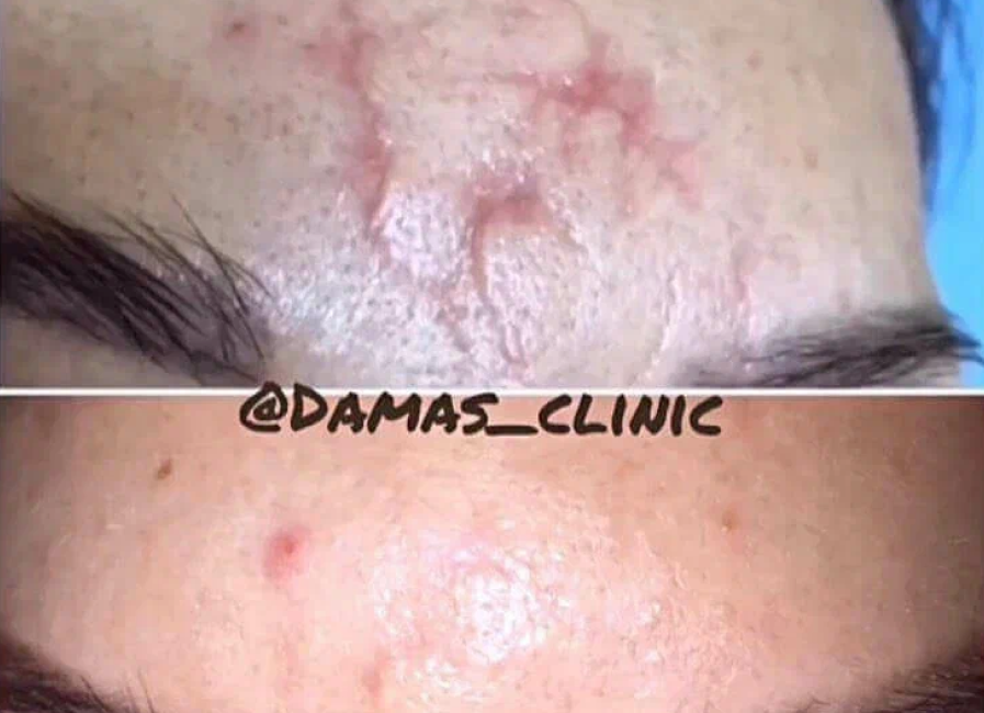 Пример работы