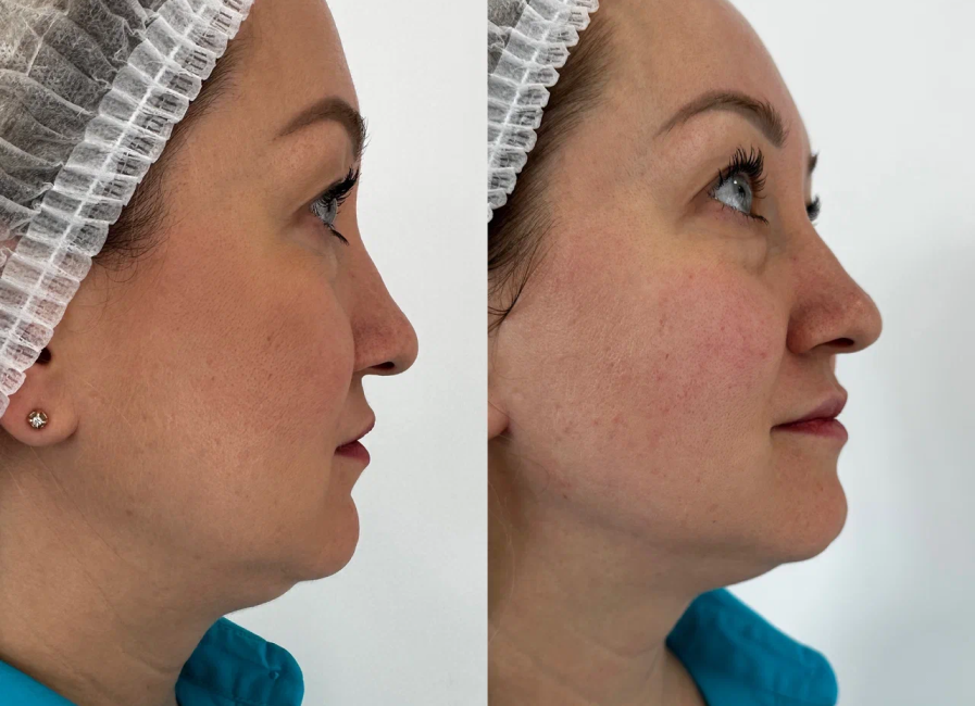 Пример работы