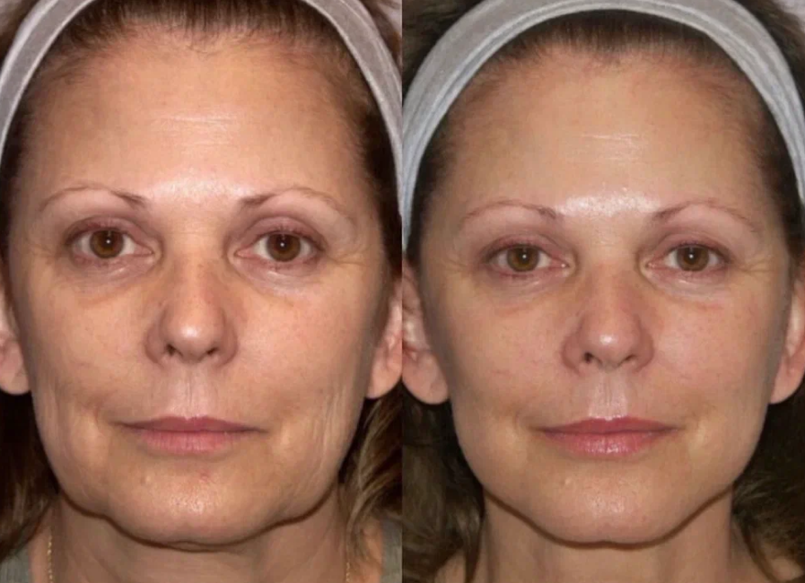 Пример работы