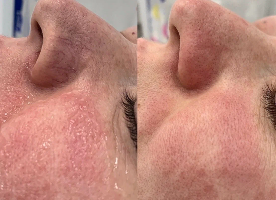 Пример работы