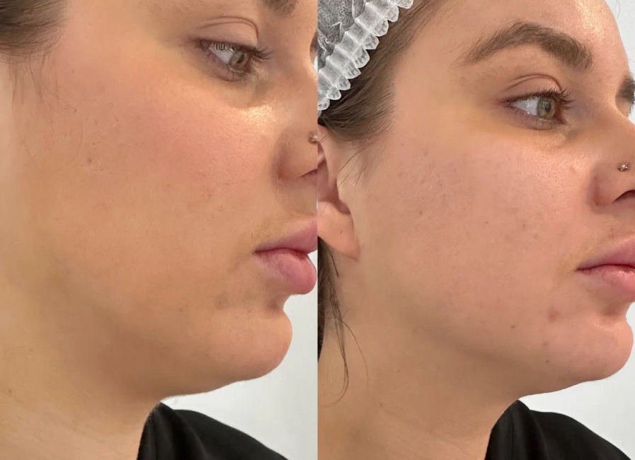 Пример работы