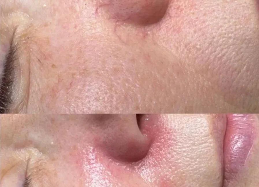 Пример работы