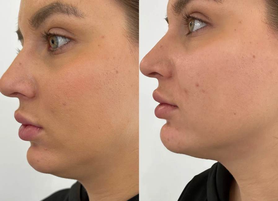 Пример работы